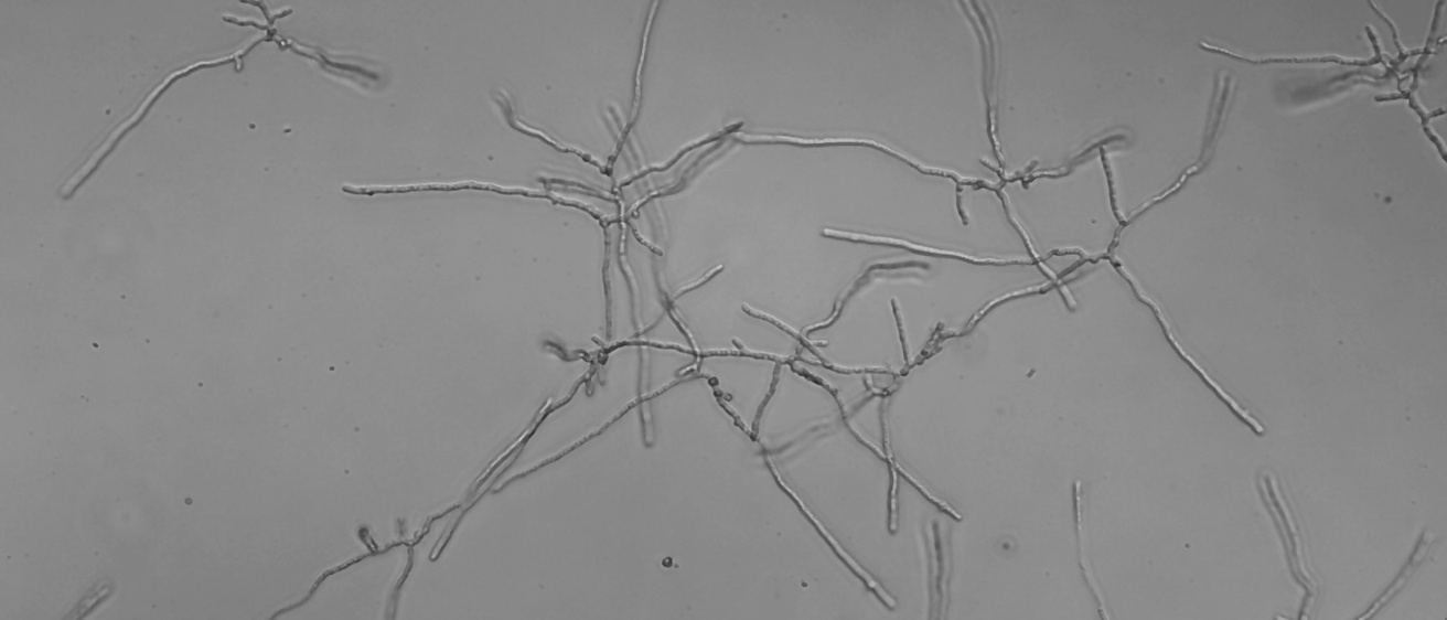 A. fumigatus hyphae in liquid culture